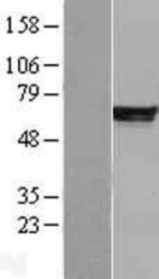 Western Blot: PDE4B Overexpression Lysate (Adult Normal) [NBL1-14219] Left-Empty vector transfected control cell lysate (HEK293 cell lysate); Right -Over-expression Lysate for PDE4B.