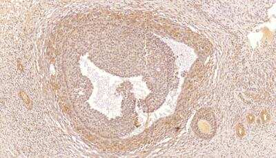 Immunohistochemistry: PDE4C Antibody [NB300-681] - Staining of PDE4C with human ovarian medulla tissue.