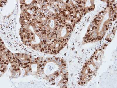 Immunohistochemistry-Paraffin: PDE4C Antibody [NBP1-32341] - Paraffin-embedded endo mitral, using antibody at 1:100 dilution.