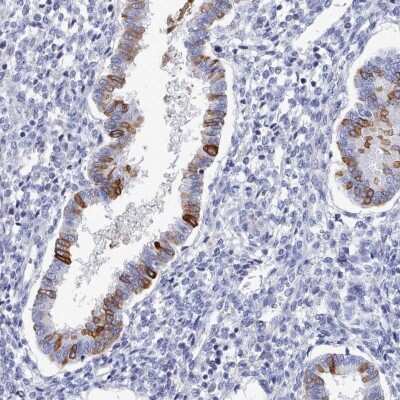 Immunohistochemistry-Paraffin: PDE4C Antibody [NBP2-33543] - Staining of human endometrium shows high expression.