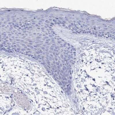 Immunohistochemistry-Paraffin PDE4C Antibody