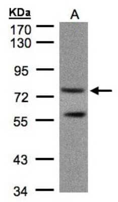 Western Blot PDE4C Antibody