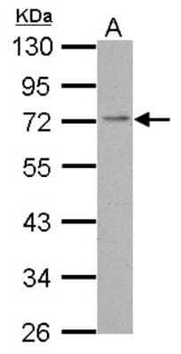 Western Blot: PDE4C Antibody [NBP2-19746] - Sample (30 ug of whole cell lysate) A: A431 10% SDS PAGE gel, diluted at 1:1000.