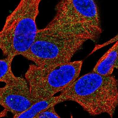 Immunocytochemistry/Immunofluorescence: PDE6 beta Antibody [NBP2-56205] - Staining of human cell line SH-SY5Y shows localization to cytosol.