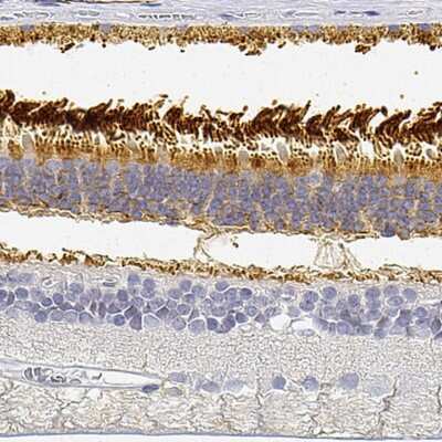 Immunohistochemistry-Paraffin: PDE6 beta Antibody [NBP2-56205] - Staining of human retina shows strong cytoplasmic positivity in photoreceptor cells and outer plexiform layer.