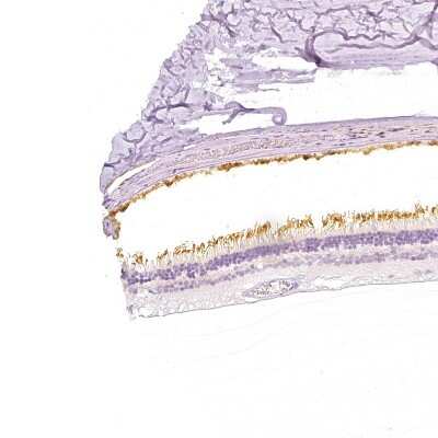 Immunohistochemistry-Paraffin: PDE6 beta Antibody [NBP2-58654] - Staining of human retina shows strong positivity in photoreceptor cells.