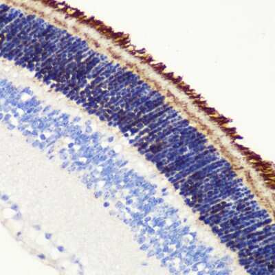 Immunohistochemistry-Paraffin: PDE6 beta Antibody [NBP2-95225] - Paraffin-embedded mouse retina using PDE6 beta .