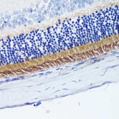 Immunohistochemistry-Paraffin: PDE6 beta Antibody [NBP2-95225] - Paraffin-embedded rat retina using PDE6 beta .