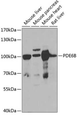 Western Blot: PDE6 beta Antibody [NBP2-95225] - Analysis of extracts of various cell lines, using PDE6 beta at 1:1000 dilution. Secondary antibody: HRP Goat Anti-Rabbit IgG (H+L) at 1:10000 dilution. Lysates/proteins: 25ug per lane. Blocking buffer: 3% nonfat dry milk in TBST. Detection: ECL Basic Kit . Exposure time: 90s.