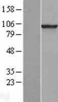 Western Blot: PDE6 beta Overexpression Lysate (Adult Normal) [NBL1-14227] Left-Empty vector transfected control cell lysate (HEK293 cell lysate); Right -Over-expression Lysate for PDE6 beta.