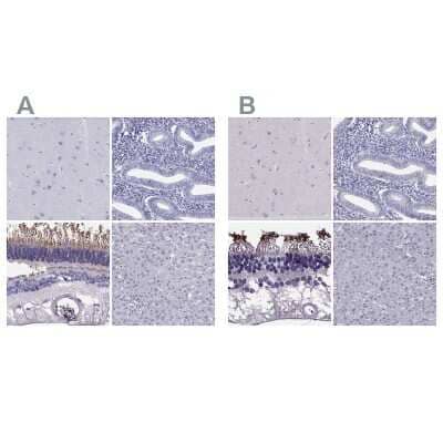 Immunohistochemistry-Paraffin PDE6A Antibody