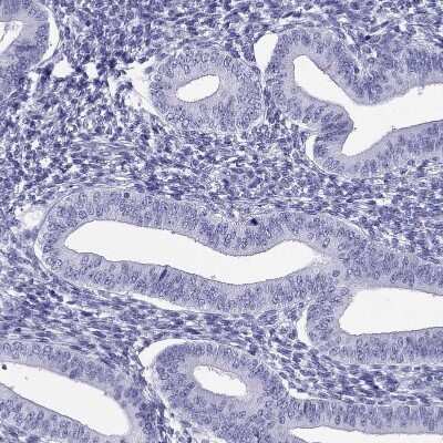 Immunohistochemistry-Paraffin: PDE6A Antibody [NBP1-87312] - Staining of human endometrium shows no positivity in glandular cells as expected.