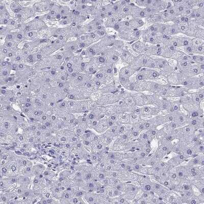 Immunohistochemistry-Paraffin: PDE6A Antibody [NBP1-87312] - Staining of human liver shows no positivity in hepatocytes as expected.