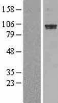 Western Blot: PDE6A Overexpression Lysate (Adult Normal) [NBL1-14226] Left-Empty vector transfected control cell lysate (HEK293 cell lysate); Right -Over-expression Lysate for PDE6A.