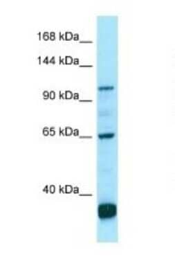 Western Blot: PDE6C Antibody [NBP1-98502] - Titration: 1.0 ug/ml Positive Control: OVCAR-3 Whole Cell.