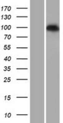 Western Blot: PDE6C Overexpression Lysate (Adult Normal) [NBP2-07653] Left-Empty vector transfected control cell lysate (HEK293 cell lysate); Right -Over-expression Lysate for PDE6C.