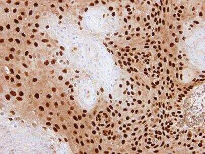 Immunohistochemistry-Paraffin PDE6D Antibody