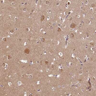Immunohistochemistry-Paraffin: PDE6D Antibody [NBP1-86275] - Staining of human cerebral cortex shows moderate cytoplasmic positivity in neurons.