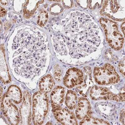 Immunohistochemistry-Paraffin: PDE6D Antibody [NBP1-86275] - Staining of human kidney shows moderate cytoplasmic positivity in cells in tubules and no positivity in cells in glomeruli as expected.