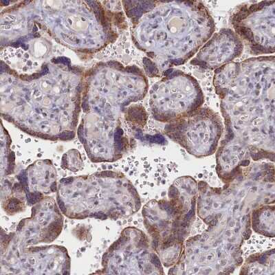 Immunohistochemistry-Paraffin: PDE6D Antibody [NBP1-86275] - Staining of human placenta shows moderate cytoplasmic positivity in trophoblastic cells.