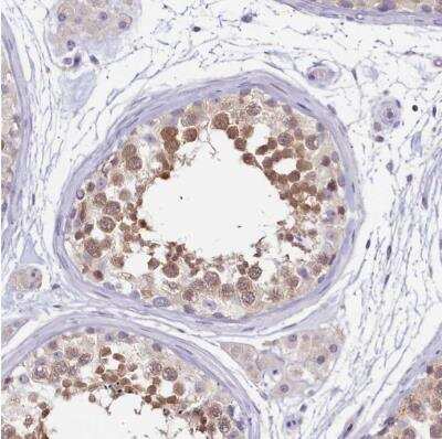 Immunohistochemistry-Paraffin: PDE6D Antibody [NBP2-38346] - Staining of human testis shows moderate to strong cytoplasmic positivity in cells in seminiferous ducts.