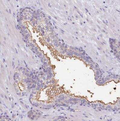 Immunohistochemistry-Paraffin: PDE6D Antibody [NBP2-38346] - Staining of human prostate shows moderate to strong positivity in plasma membrane in glandular cells.