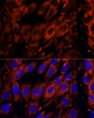 Immunocytochemistry/ Immunofluorescence PDE6G Antibody - Azide and BSA Free