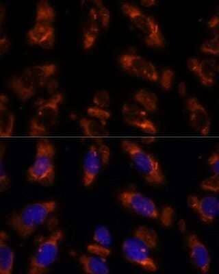 Immunocytochemistry/Immunofluorescence: PDE6G Antibody [NBP2-93029] - Analysis of U-2 OS cells using PDE6G at dilution of 1:100. Blue: DAPI for nuclear staining.