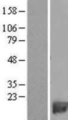 Western Blot: PDE6H Overexpression Lysate (Adult Normal) [NBL1-14229] Left-Empty vector transfected control cell lysate (HEK293 cell lysate); Right -Over-expression Lysate for PDE6H.
