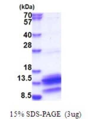 SDS-PAGE Recombinant Human PDE6H His Protein