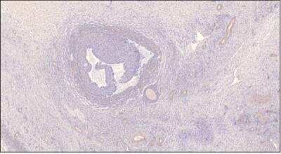 Immunohistochemistry-Paraffin: PDE7B Antibody [NBP3-12246] - Human Ovarian Medulla. 1:150 antibody dilution.