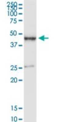Western Blot: PDE7B Antibody [H00027115-D01P] - Analysis of PDE7B expression in human colon.