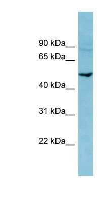 Western Blot: PDE7B Antibody [NBP1-52979] - MCF-7 whole cell lysates, concentration 0.2-1 ug/ml.