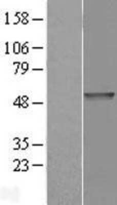 Western Blot: PDE7B Overexpression Lysate (Adult Normal) [NBL1-14231] Left-Empty vector transfected control cell lysate (HEK293 cell lysate); Right -Over-expression Lysate for PDE7B.