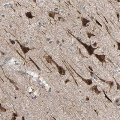 Immunohistochemistry-Paraffin: PDE8A Antibody [NBP1-83160] - Staining of human cerebral cortex shows strong cytoplasmic positivity in neuronal cells.