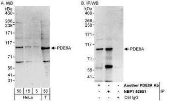 Western Blot: PDE8A Antibody [NBP1-52651] - Whole cell lysate from HeLa (5, 15 and 50 mcg for WB; 1 mg for IP, 20% of IP loaded) and 293T (T; 50 mcg) cells.  Antibodies: Affinity purified rabbit anti-PDE8A antibody used for WB at 0.1 mcg/ml (A) and 1 mcg/ml (B) and used for IP at 6 mcg/mg lysate.  PDE8A was also immunoprecipitated by another rabbit anti-PDE8A antibody, which recognizes an upstream epitope.