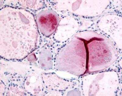 Immunohistochemistry-Paraffin: PDE8B Antibody [NB110-40458] - Analysis of anti-PDE8B antibody with human thyroid at concentration 10 ug/ml.