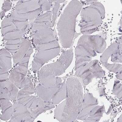 Immunohistochemistry-Paraffin: PDE8B Antibody [NBP1-86280] - Staining of human skeletal muscle shows low expression as expected.