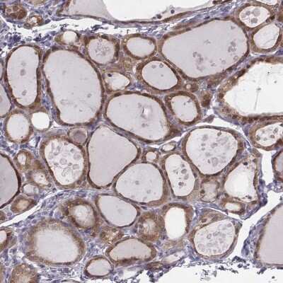 Immunohistochemistry-Paraffin: PDE8B Antibody [NBP1-86280] - Staining of human thyroid gland shows high expression.