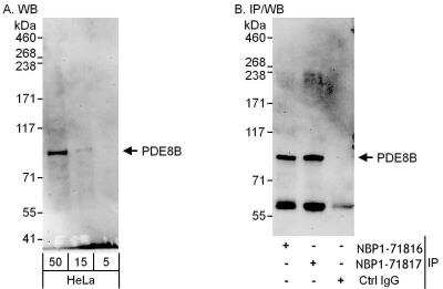Immunoprecipitation: PDE8B Antibody [NBP1-71817] - Samples: Whole cell lysate (5, 15 and 50 ug for WB; 1 mg for IP, 20% of IP loaded) from HeLa cells.  Antibodies: Affinity purified rabbit anti-PDE8B antibody used for WB at 1 ug/ml (A and B) and used for IP at 6 ug/mg lysate.  PDE8B was also immunoprecipitated by rabbit anti-PDE8B antibody, which recognizes a downstream epitope.  Detection: Chemiluminescence with exposure times of 3 minutes (A and B).