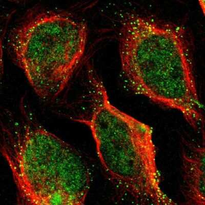 <b>Orthogonal Strategies Validation. </b>Immunocytochemistry/Immunofluorescence: PDE9A Antibody [NBP1-86478] - Staining of human cell line U-2 OS shows localization to nucleoplasm & vesicles.