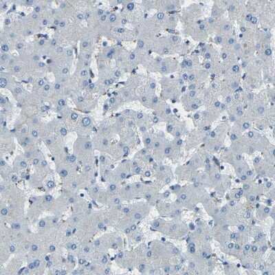 Immunohistochemistry-Paraffin: PDE9A Antibody [NBP1-86478] - Staining of human liver shows low expression as expected.