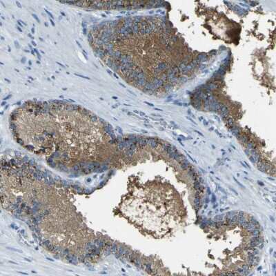 Immunohistochemistry-Paraffin: PDE9A Antibody [NBP1-86478] - Staining of human prostate shows high expression.