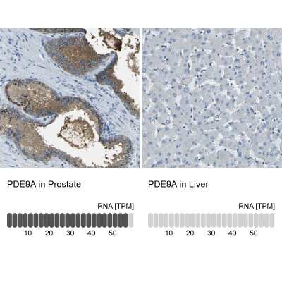 Immunohistochemistry-Paraffin: PDE9A Antibody [NBP1-86478] - Staining in human prostate and liver tissues using anti-PDE9A antibody. Corresponding PDE9A RNA-seq data are presented for the same tissues.