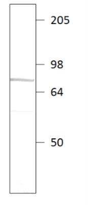 Western Blot: PDE9A Antibody [NBP3-12248] - WB NBP3-12248. 1:500 antibody dilution in DiluOBuffer. Apparent MW is 70-72 kDa. 