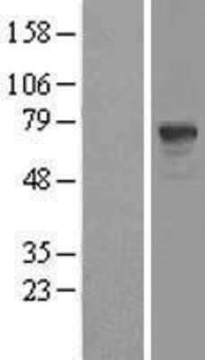 Western Blot: PDE9A Overexpression Lysate (Adult Normal) [NBL1-14233] Left-Empty vector transfected control cell lysate (HEK293 cell lysate); Right -Over-expression Lysate for PDE9A.