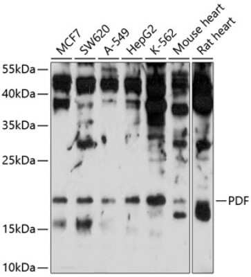 Western Blot: PDF Antibody [NBP2-93533] - Analysis of extracts of various cell lines, using PDF at 1:1000 dilution. Secondary antibody: HRP Goat Anti-Rabbit IgG (H+L) at 1:10000 dilution. Lysates/proteins: 25ug per lane. Blocking buffer: 3% nonfat dry milk in TBST. Detection: ECL Basic Kit . Exposure time: 30s.