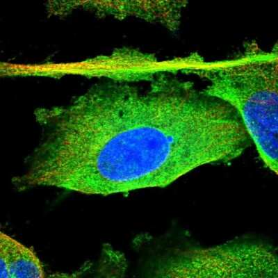 Immunocytochemistry/Immunofluorescence: PDGF-C Antibody [NBP1-83935] - Immunofluorescent staining of human cell line U-251 MG shows localization to plasma membrane & cytosol. Antibody staining is shown in green.