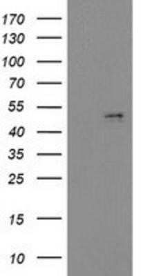 Western Blot: PDGF-D/SCDGFB Antibody (OTI1C1) - Azide and BSA Free [NBP2-73305] - HEK293T cells were transfected with the pCMV6-ENTRY control (Left lane) or pCMV6-ENTRY SCDGFB (Right lane) cDNA for 48 hrs and lysed. Equivalent amounts of cell lysates (5 ug per lane) were separated by SDS-PAGE and immunoblotted with anti-SCDGFB.