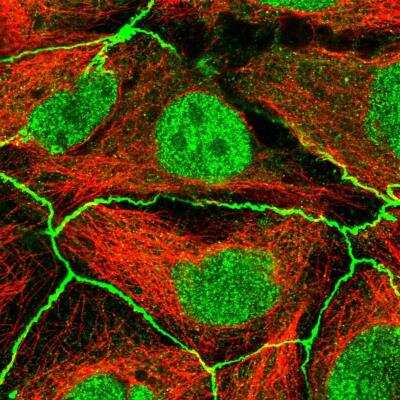 Immunocytochemistry/Immunofluorescence: PDGF R alpha Antibody [NBP2-76508] - Staining of human cell line CACO-2 shows localization to nucleoplasm, plasma membrane & cell junctions. Antibody staining is shown in green.
